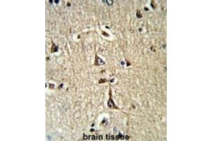 Immunohistochemistry (IHC) image for anti-Glycerol-3-Phosphate Dehydrogenase 1 (Soluble) (GPD1) antibody (ABIN3003779)