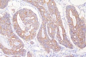 IHC analysis of DSG2 using anti-DSG2 antibody (ABIN7600803). (Desmoglein 2 anticorps  (AA 24-1020))