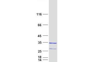 Validation with Western Blot