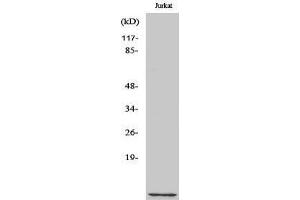 Western Blotting (WB) image for anti-CDC28 Protein Kinase Regulatory Subunit 1B (CKS1B) (N-Term) antibody (ABIN3174414) (CKS1 anticorps  (N-Term))