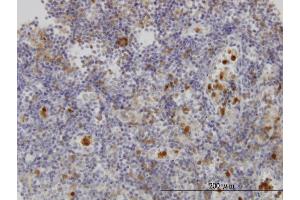 Immunoperoxidase of monoclonal antibody to FGR on formalin-fixed paraffin-embedded human lymph node.