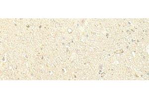Immunohistochemistry of paraffin-embedded Human brain tissue using SPIRE1 Polyclonal Antibody at dilution of 1:60(x200) (SPIRE1 anticorps)