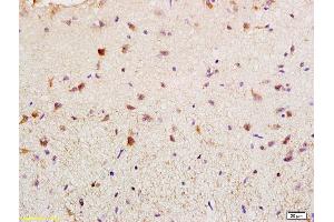 Formalin-fixed and paraffin embedded rat brain labeled with Rabbit Anti BAG2 Polyclonal Antibody, Unconjugated (ABIN755347) at 1:200 followed by conjugation to the secondary antibody and DAB staining (BAG2 anticorps  (AA 151-211))