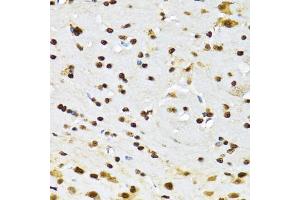 Immunohistochemistry of paraffin-embedded mouse brain using CCAR2 antibody (ABIN2563550) at dilution of 1:100 (40x lens). (CCAR2 anticorps)