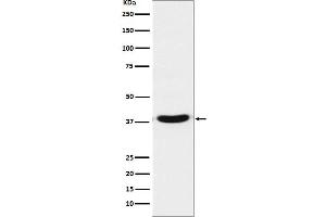 Western blot analysis of VPS26 expression in A431 cell lysate.