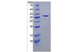 SDS-PAGE of Protein Standard from the Kit (Highly purified E. (Cathepsin K Kit ELISA)