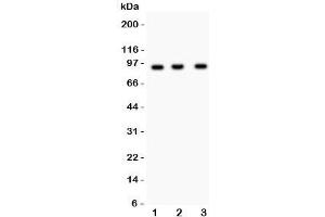 Western blot testing of NEDD9 antibody and Lane 1:  Jurkat;  2: CEM;  3: Raji lysate. (NEDD9 anticorps)