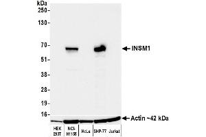 Western Blotting (WB) image for anti-Insulinoma-Associated 1 (INSM1) (AA 75-125) antibody (ABIN7795670) (Recombinant INSM1 anticorps  (AA 75-125))