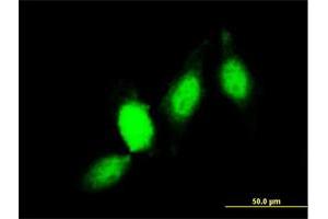 Immunofluorescence of monoclonal antibody to GSTP1 on HeLa cell. (GSTP1 anticorps  (AA 1-210))