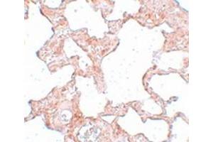 Immunohistochemical staining of rat lung tissue with SGK493 polyclonal antibody  at 25 ug/mL dilution.