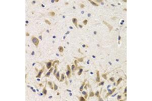 Immunohistochemistry of paraffin-embedded rat brain using UAP1 antibody at dilution of 1:200 (400x lens). (UAP1 anticorps)