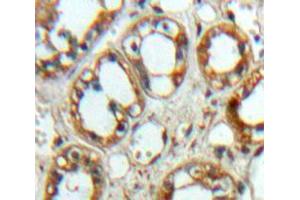 Used in DAB staining on fromalin fixed paraffin-embedded Kidney tissue