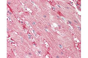 Human Heart: Formalin-Fixed, Paraffin-Embedded (FFPE)