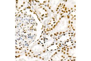 Immunohistochemistry of paraffin-embedded rat kidney using Phospho-POLR2A CTD-S2 Rabbit mAb  at dilution of 1:200 (40x lens). (POLR2A/RPB1 anticorps  (pSer2))