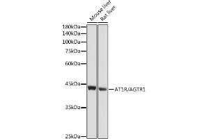 Western blot analysis of extracts of various cell lines, using R/ antibody (ABIN6133546, ABIN6136653, ABIN6136654 and ABIN6218484) at 1:1000 dilution. (Angiotensin II Type-1 Receptor anticorps  (AA 250-350))