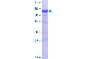 Image no. 1 for Nucleoredoxin (NXN) (AA 1-435) protein (GST tag) (ABIN1313277)