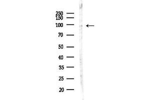 Western blot analysis of lysates from MDA-MB-231 cells(heat-shock,45 min treatment), using TRPC3 Antibody at 1/1000 dilution.