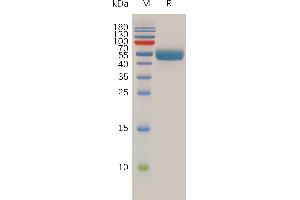 Human Protein, hFc Tag on SDS-PAGE under reducing condition.
