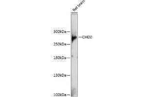 Western blot analysis of extracts of rat brain, using CHD2 antibody (ABIN6133621, ABIN6138503, ABIN6138507 and ABIN6217491) at 1:1000 dilution. (CHD2 anticorps  (C-Term))