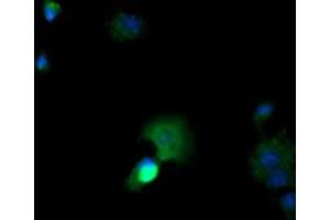 Image no. 2 for anti-Cancer/testis Antigen 1B (CTAG1B) antibody (ABIN1499889) (CTAG1B anticorps)