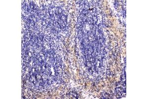 IHC testing of FFPE mouse spleen tissue with RAB27A antibody at 1ug/ml. (RAB27A anticorps)