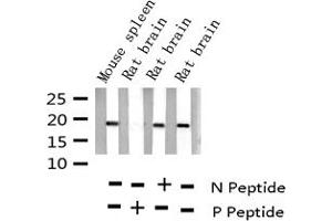 Western blot analysis of Phospho-Stathmin 1 (Ser15) expression in various lysates (Stathmin 1 anticorps  (pSer15))