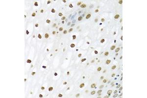 Immunohistochemistry of paraffin-embedded human esophagus using PTBP1 antibody (ABIN5995415) at dilution of 1/100 (40x lens). (PTBP1 anticorps)