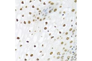 Immunohistochemistry of paraffin-embedded human esophagus using PTBP1 antibody (ABIN5995415) at dilution of 1/100 (40x lens).