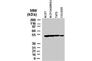 Western blot analysis of BIRC4 in various tumor cell lines recombinant BIRC4 polyclonal antibody  at 1 : 2000. (XIAP anticorps)