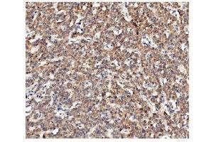 IHC analysis of Ch TOG/CKAP5 using anti-Ch TOG/CKAP5 antibody (ABIN7599106). (CKAP5 anticorps  (AA 1-221))