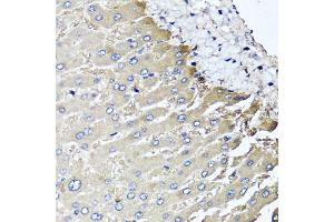 Immunohistochemistry of paraffin-embedded human liver injury using MGAT1 antibody. (MGAT1 anticorps)