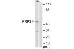 Western blot analysis of extracts from HeLa cells, using PRP31 Antibody. (PRPF31 anticorps  (AA 331-380))