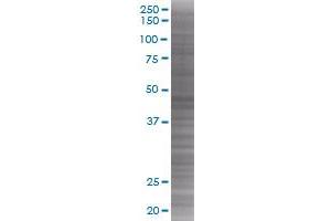 CAMK2A transfected lysate (CAMK2A 293T Cell Transient Overexpression Lysate(Denatured))