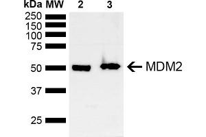 Western blot analysis of Mouse, Rat Brain showing detection of ~40 kDa MDM2 protein using Rabbit Anti-MDM2 Polyclonal Antibody (ABIN5667992).