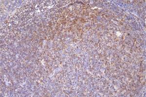 IHC analysis of DCK using anti-DCK antibody (ABIN7600254). (DCK anticorps  (AA 17-260))