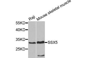 Western blot analysis of extracts of Raji and mouse skeletal muscle cells, using SSX5 antibody. (SSX5 anticorps)