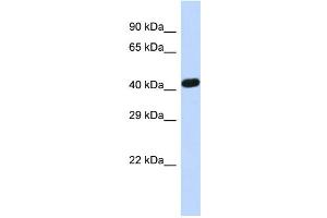 Host:  Rabbit  Target Name:  ZNF773  Sample Type:  Hela whole cell lysates  Antibody Dilution:  1. (ZNF773 anticorps  (Middle Region))