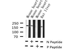 Western blot analysis of Phospho-HER2 (Tyr877) expression in various lysates (ErbB2/Her2 anticorps  (pTyr877))