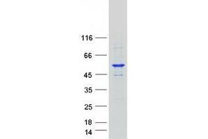Validation with Western Blot