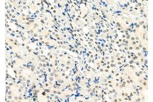 ABIN6265199 and ABIN6273321 at 1/100 staining Rat kidney tissue by IHC-P. (SMYD3 anticorps  (N-Term))