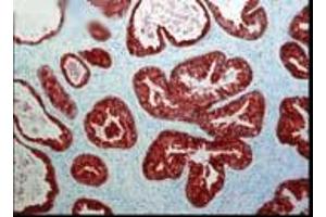 FKBP52 (Hi52C) Prostate tissue (strong staining in ductal epithelial cells Courtesy of the Mayo Clinic.