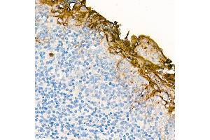 Immunohistochemistry of paraffin-embedded Human tonsil (negative control sample) using CE antibody (ABIN7266084) at dilution of 100 (40x lens).