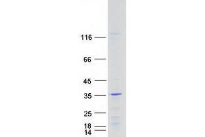 Validation with Western Blot