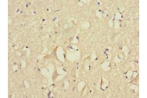 Immunohistochemistry of paraffin-embedded human brain tissue using ABIN7152777 at dilution of 1:100