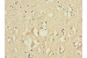 Immunohistochemistry of paraffin-embedded human brain tissue using ABIN7152777 at dilution of 1:100 (FGF12 anticorps  (AA 1-181))