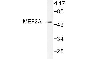Image no. 1 for anti-Myocyte Enhancer Factor 2A (MEF2A) antibody (ABIN271871) (MEF2A anticorps)