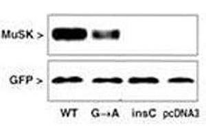 Western blot testing of COS cells after transfection with MUSK mutated and GFP (control) with MUSK antibody.