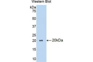 Western blot analysis of the recombinant protein. (PLA1A anticorps  (AA 309-452))