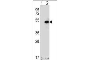 Western blot analysis of SPHK1 (arrow) using rabbit polyclonal SPHK1 Antibody (C-term ) (ABIN652302 and ABIN2837969). (SPHK1 anticorps  (C-Term))