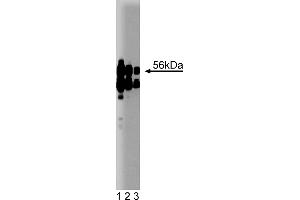 Western Blotting (WB) image for anti-Protein Phosphatase 2, Regulatory Subunit B', alpha (PPP2R5A) (AA 1-162) antibody (ABIN968065) (PPP2R5A anticorps  (AA 1-162))